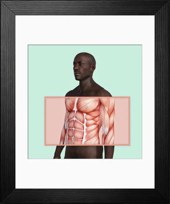 Framed Print : bald, body, chest, close up, color image, concept, condition, copy space, cut out Framed Print : bald, body, chest, close up, color image, concept, condition, copy space, cut out